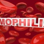 Hemophilia-450